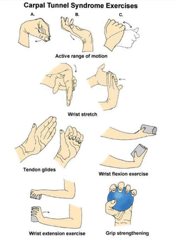 Tips to Prevent Wrist Aches and Carpal Tunnel